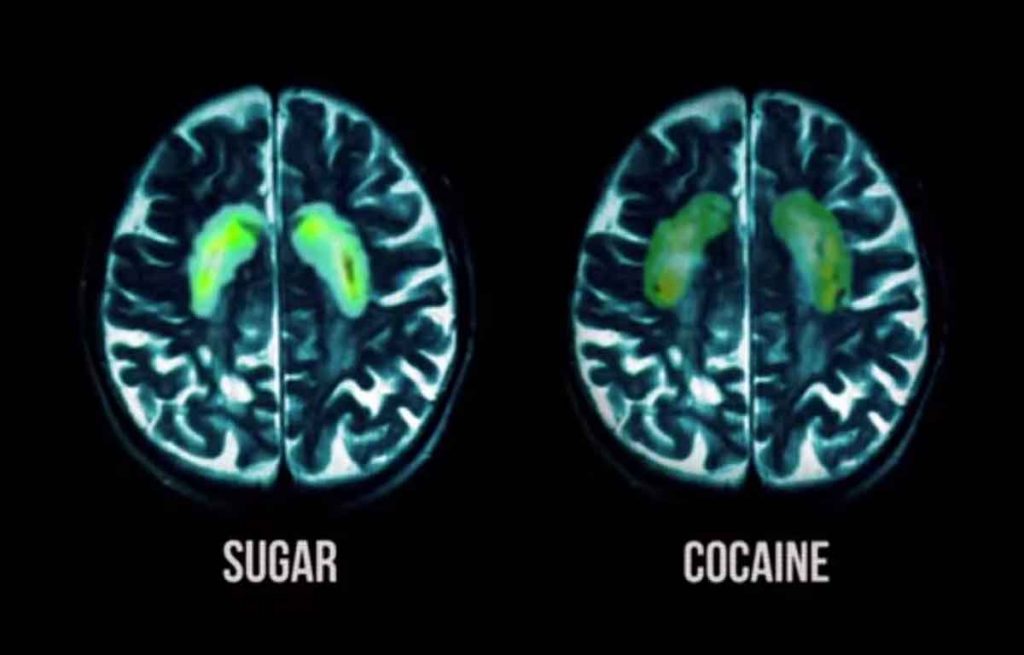 por qué el azúcar es tan adictivo